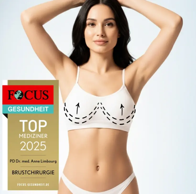 Focus Ärzteliste Top Mediziner Brustchirurgie, good looking woman with bikini showing markings on bra for breast contour.